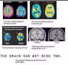 There can be various causes of the same type of brain abnormality. Are These Brain Scan Images Real See Source Do They Support The Idea That The The Brain Can Get Sick Too Quora