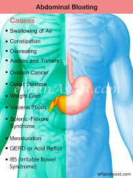 People with this type of cancer may experience painful symptoms that include abdominal pain and bloating, kidney pain, constipation bloating. Abdominal Bloating Home Remedies And Prevention Tips