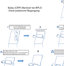 The epley maneuver or repositioning maneuver is a maneuver used by medical professionals to treat one common cause of vertigo, benign paroxysmal positional vertigo (bppv) of the posterior or anterior canals of the ear. Https Www Awmf Org Uploads Tx Szleitlinien 053 018k S3 Akuter Schwindel Hausarztpraxis 2017 02 Verlaengert 1 Abgelaufen Pdf