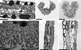 Image result for Rothia hirsuta