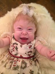 Mum desperately makes memories for girl who will die in a year