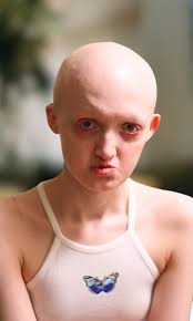 Despite their disabilities, sisters Ava and Jessa have become beauty  pageant queens 🙌