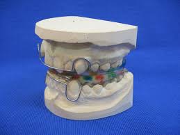 Alegand magazinul nostru ai parte de posibilitatea cumpararii in. Studium Techniki Dentystycznej Km Dental Wroclaw Aparaty Czynnosciowe I Mechaniczno Czynnosciowe