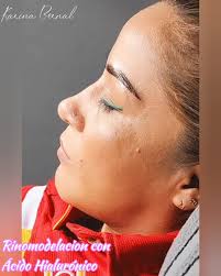 Vídeos de Karina Bernal (@anirak1996) con «original sound