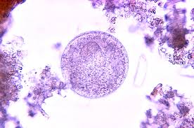 Image result for Balantoides Coli