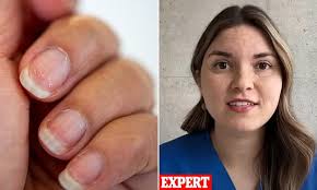 Neil Warnock's wife Sharon describes lymphoedema struggle