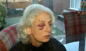 Fury as thug jailed for battering woman police officer after she tried to  help him serves 76 DAYS