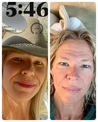 Positive experience with skin care and cosmetic procedures at High Horse  1898