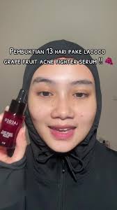 Review Lacoco Acne Serum: Love Love Serum Ini 🥹🫶🏻