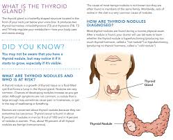 90 Of All Thyroid Nodules Are Non Cancerous But It Is Important To Get Them Check Learn Why Thyroid Thyroid Nodules Thyroid Disorders