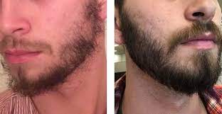 How facial hair develops and how you can make it thicker. My Beard Aging Age 17 23 Beards