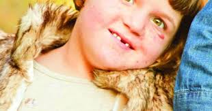 Fundraiser to help 8-year-old Emporian with genetic disorder