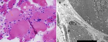 Installing recessed lights is an inexpensive way to update the appearance of your home. Soxhu Go Aw8vm