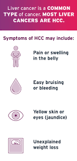 In the united states, doctors usually discover signs of liver cancer when screening people for an underlying liver condition, such as chronic hepatitis. What Is Hepatocellular Carcinoma Hcc Tecentriq Atezolizumab