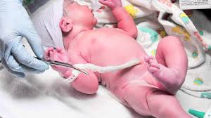 You can find out more about caring for your baby's umbilical cord on the nhs website by clicking here. Here S The Proper Way To Clean Your Baby S Umbilical Cord Babymigo