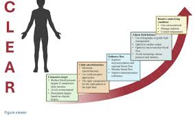 Image result for Vasopressor