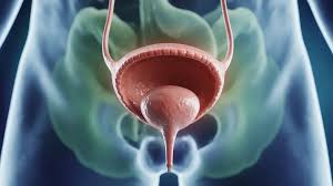 Image result for Urinary Retention