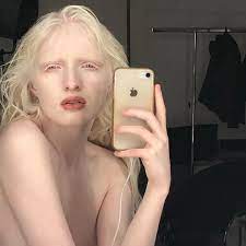 Albinism nude - 62 фото