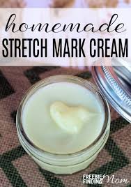 Homemade Stretch Mark Cream With Coconut Oil Stretch Mark Cream Natural Stretch Mark Cream Stretch Marks