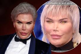 Rodrigo alves, the man commonly known as the human ken doll, looked dramatically different before his £450,000 worth of plastic surgery.alves, who has spent. Rodrigo Alves Surgeries In Full As She Comes Out As Trans And Unveils New Identity Mirror Online