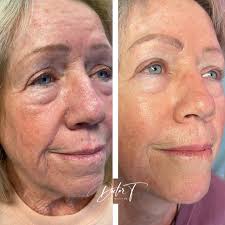 ✨Our wonderful client has literally aged backwards right before our  eyes!!!! 🤩 we couldn't wait to share these pictures!! 📸 The before and  afters are a year and a half apart with