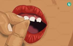 Mustard oil and honey are antibacterial agents with many potential benefits. Loose Tooth Symptoms Pain Causes Treatment Prevention Medicine Diagnosis