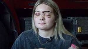 Girl, mom, first responder recall frightening crash that pinned teens  beneath UTV