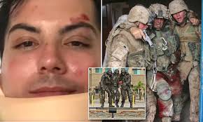 Iraq vet Chris Marquez was beaten by teens who asked him if 'black lives  matter'