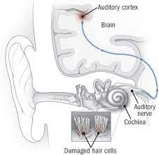 Previous tennitus louder after ear infection. Tinnitus Ringing In The Ears And What To Do About It Harvard Health