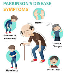 While no two people experience parkinson's the same way, there are some commonalities. Free Vector Parkinson Disease Symptoms Infographic