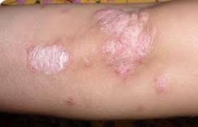 [Image: images?q=tbn:ANd9GcSPSljEqzKll_CdK4m1fjk...7cRc7VRbFv]