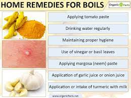 Pin By Arali Rodriguez On Beauty Cleansing And More Home Remedy For Boils Garlic Juice Home Remedies