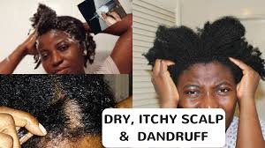 The end product will be soft, but will be packed full of nutrients your hair will be soft and shiny without the need for conditioner. Treating Dandruff With African Black Soap Kenny Olapade