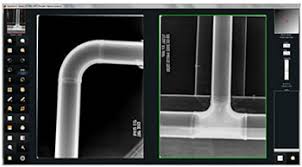 Digital X Ray With Tigerview Ndt