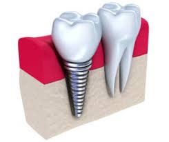 5 Tips To Maintain Great Oral Health