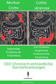 Ced Was Sind Chronisch Entzundliche Darmerkrankungen