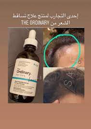 the ordinary اورديناري on twitter سيروم الشعر من أورديناري المنتج الوحيد المخصص للشعر من ذا اورديناري يستخدم على جذور الشعر فقط وتسوين مساج الجميل فيه انه ما يحتاج تغسلينه مافيه ريحه ولا