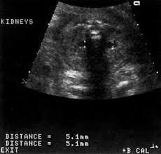 When you visit any website, it may store or retrieve information on your browser, mostly in the form of cookies. Ultrasound Diagnosis Of Fetal Anomalies Glowm
