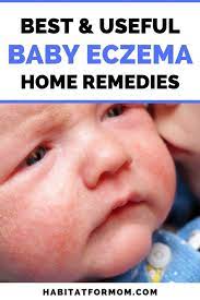 Best Remedies For Baby Eczema Ultimate List Habitat For Mom Baby Eczema Remedies Baby Eczema Baby Eczema Treatment