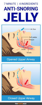 Stop Your Snoring Naturally And Immediately Tonight With This Anti Snoring Jelly Home Remedy It Really Works S Snoring Natural Home Remedies Snoring Remedies