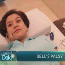 Whenever I hear about someone who has BELL'S PALSY, it brings me back to  the time when I had it too. It was a mix of surrender—bahala na si  God—because you can't