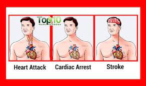 Understanding Heart Attack Cardiac Arrest And Stroke Top 10 Home Remedies Cardiac Cardiac Arrest Heart Attack