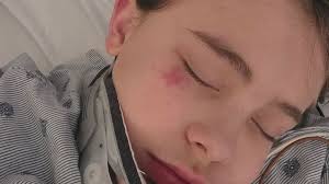 Fundraiser for Devony Carey by Jami Bennett : Support Oliver's Healing  Journey