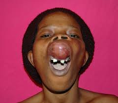 Supplies save lives in Nigeria