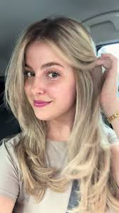 ONE YEAR UPDATE!! I dont feel like my baldness pattern has changed too...