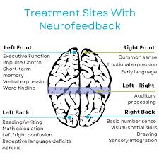 Image result for Learning Disorder