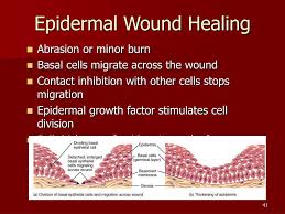Image result for epidermis healing