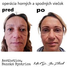 MUDr. Ján Zeleňák