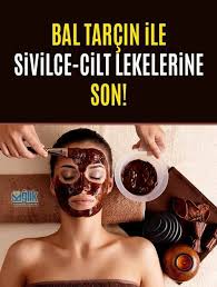 Bal Tarcin Maskesi Ile Sivilcelere Son Bal Tarcin Maskesi Ile Sivilcelere Son Face Acne Face Mapping Acne Acne