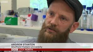 HeadUp Project: Andy Stanton interviewed for BBC Look North